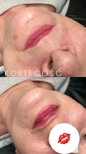 Esthetic Clinic Milena Tomczak